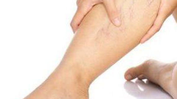 Превью картинка статьи Солевые повязки при варикозе: отзывы о лечении варикоза морской солью