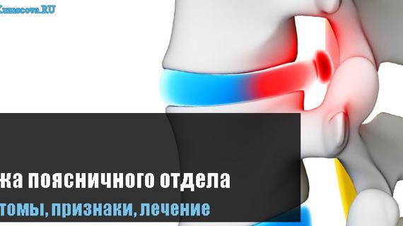 Превью картинка статьи Лечение грыжи позвоночника поясничного отдела