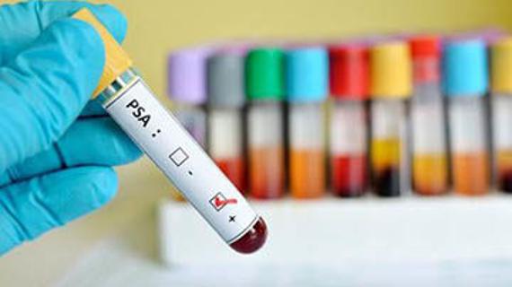 Превью картинка статьи Какие лекарства влияют на анализ пса