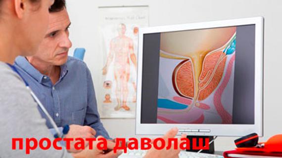 Превью картинка статьи Простата безини даволаш усуллари уй шароитида