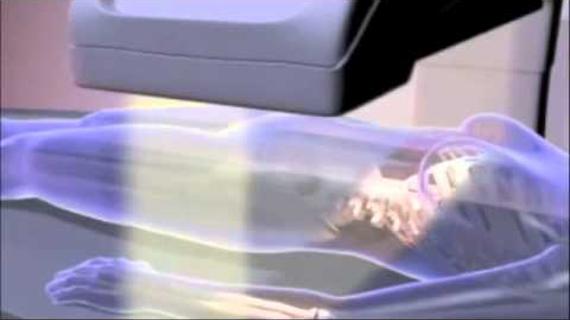 Превью картинка статьи Денситометрия костей: показания, расшифровка результатов