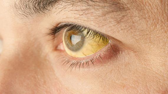 Превью картинка статьи В какие страны нужно делать прививку от желтой лихорадки