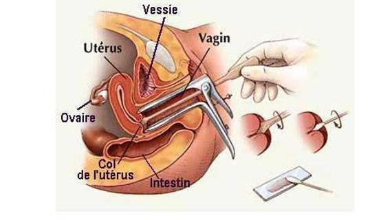 Превью картинка статьи Мазок после родов на флору и цитологию: норма и патология