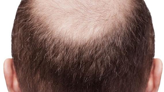 Превью картинка статьи Болезни волос: виды, причины, советы и рекомендации