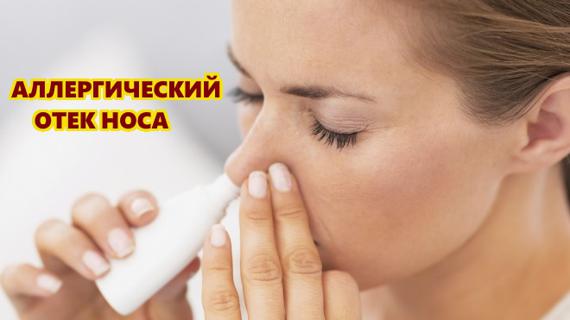 Превью картинка статьи Заложен нос капли не помогают что делать аллергия