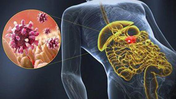 Превью картинка статьи Нужно ли вызывать скорую при поносе и рвоте