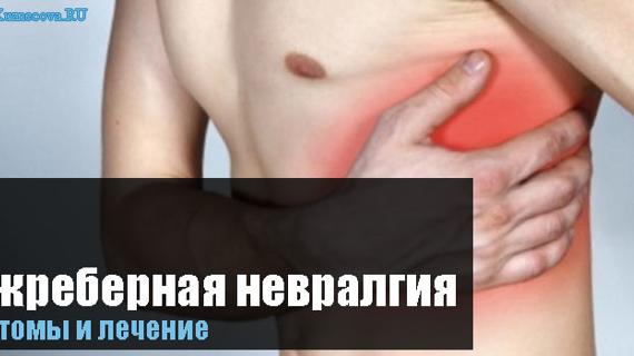 Превью картинка статьи Межрёберная невралгия, симптомы и лечение в домашних условиях [слева/справа], таблетки
