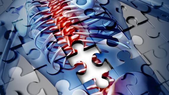 Превью картинка статьи Препараты для лечения остеопороза