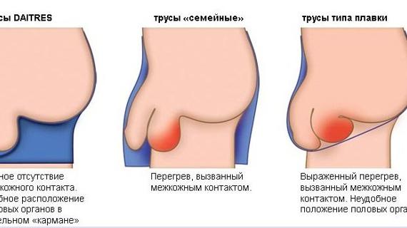 Превью картинка статьи Член уменьшился из за стресса