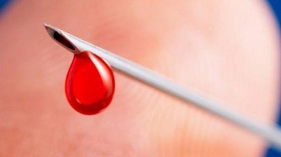 Превью картинка статьи Можно ли заразиться вич через иглу глюкометра