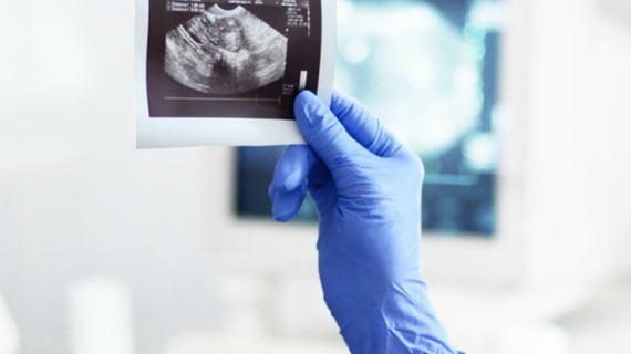 Превью картинка статьи Узи нервов нижних конечностей где сделать