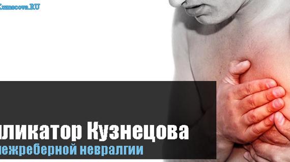 Превью картинка статьи при межреберной невралгии