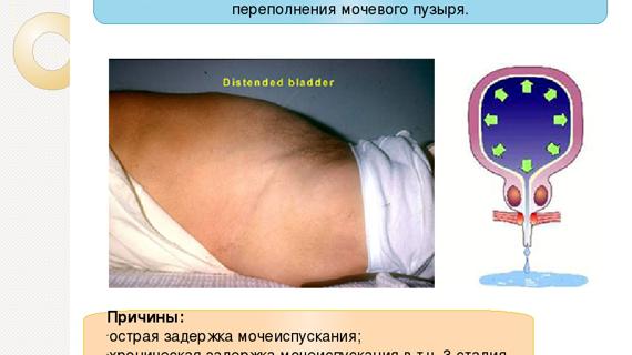 Превью картинка статьи Луиза хей энурез у детей