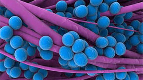 Превью картинка статьи Заразна ли фолликулярная ангина или нет и каким путем она передается 2021