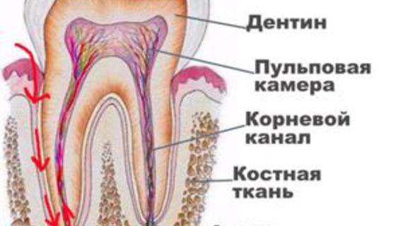Превью картинка статьи Пульпит зуба: что это такое, как лечить? Фото, симптомы