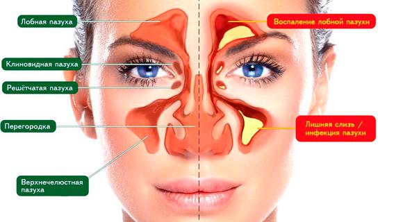 Превью картинка статьи Как в домашних условиях прочистить нос от соплей в домашних условиях
