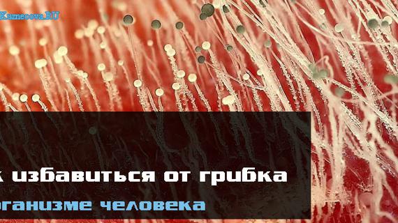 Превью картинка статьи Как избавиться от грибка в организме человека навсегда
