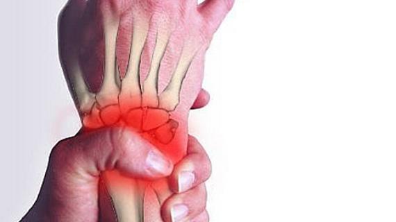Превью картинка статьи Воспаление сухожилий кисти руки: причины, симптомы и лечение