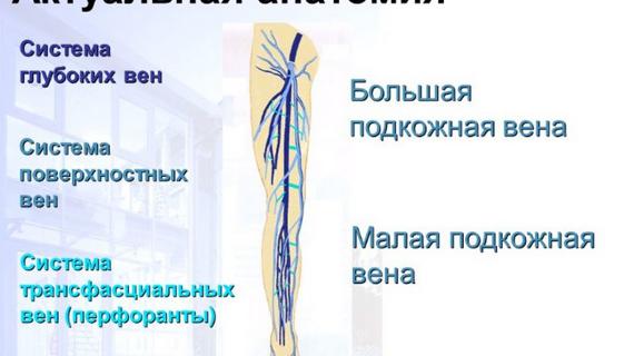 Превью картинка статьи Варикозная болезнь вен нижних конечностей: классификация
