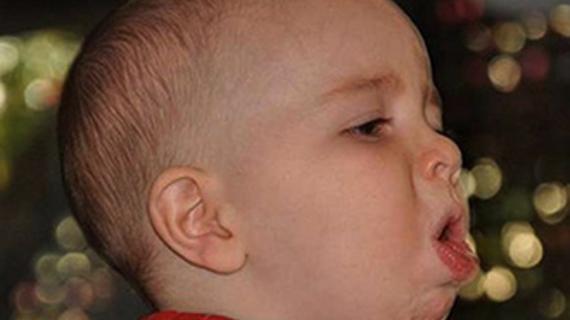 Превью картинка статьи Хрипит горло у ребенка - чем и как лечить 2021