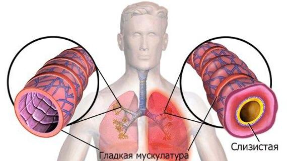 Превью картинка статьи Воспаление легких у взрослых - симптомы, как лечить, препараты и профилактика