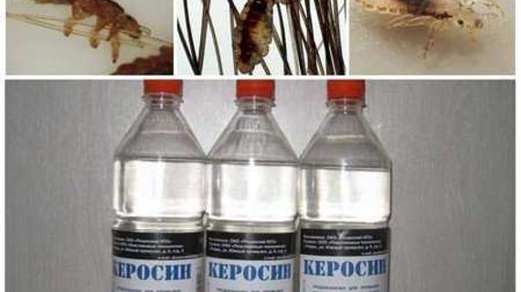 Превью картинка статьи Мыльно керосиновая эмульсия при педикулезе