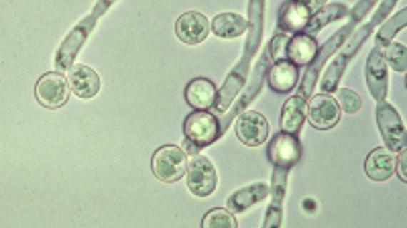 Превью картинка статьи Нистатин 250000 и 500000 разница