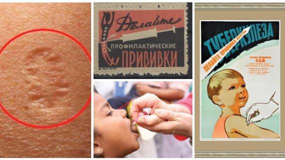 Превью картинка статьи Что делать если нет прививки от оспы