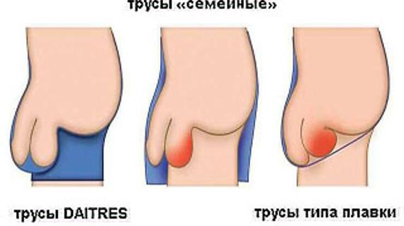 Превью картинка статьи Что делать, если застудил яички – симптомы и лечение 2021