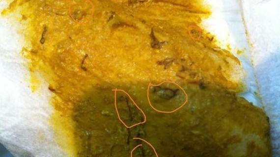 Превью картинка статьи Красные глисты у человека: фото, симптомы гельминтов в организме