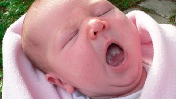 Превью картинка статьи Лекарства от кандидоза во рту у детей