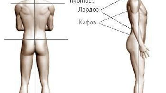 Превью картинка статьи Можно ли вылечить сколиоз на кровати нуга бест