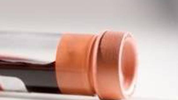 Превью картинка статьи Превышение кальция в крови о чем говорит — Про сосуды