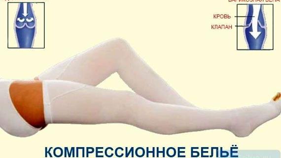 Превью картинка статьи Компрессионный трикотаж: полезные свойства, классы