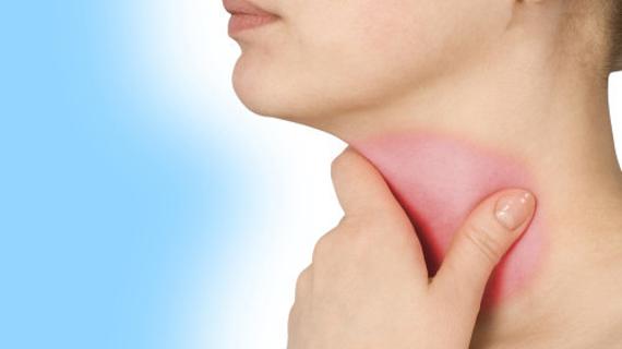 Превью картинка статьи Фарингит: виды, причины, симптомы и лечение