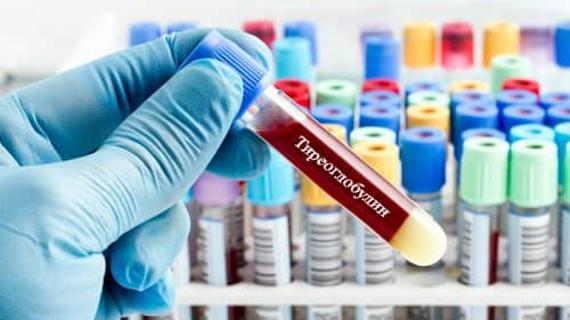 Превью картинка статьи Антитела к тиреоглобулину: причины повышения, норма у женщин (таблица), лечение