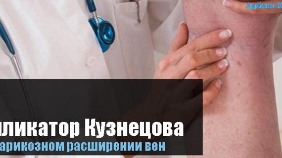 Превью картинка статьи при варикозе ног