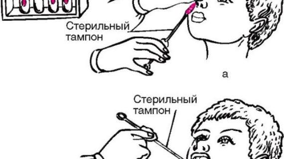 Превью картинка статьи Анализ крови после ангины у ребенка