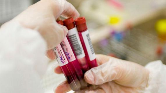 Превью картинка статьи Что такое эстрадиол у женщин норма при климаксе