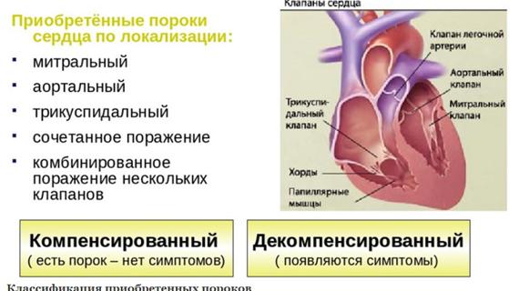 Превью картинка статьи Приобретенный порок сердца: что это такое и как его лечить