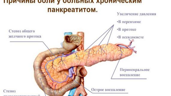 Превью картинка статьи Можно ли отжиматься при панкреатите
