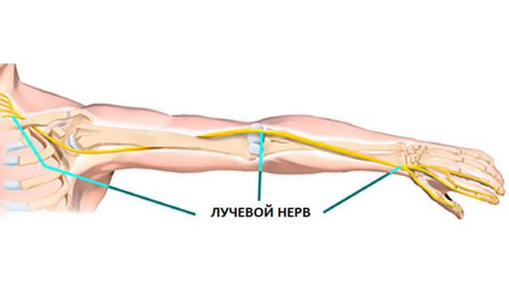 Превью картинка статьи Защемление лучевого нерва в руке: симптомы и лечение, что делать если защемило