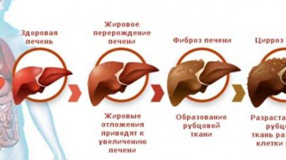 Превью картинка статьи Уплотнение печени на УЗИ: что это такое, причины и лечение, норма в единицах