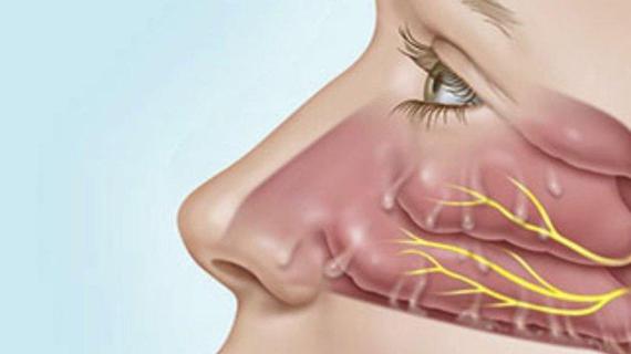 Превью картинка статьи Течет вода из носа причины