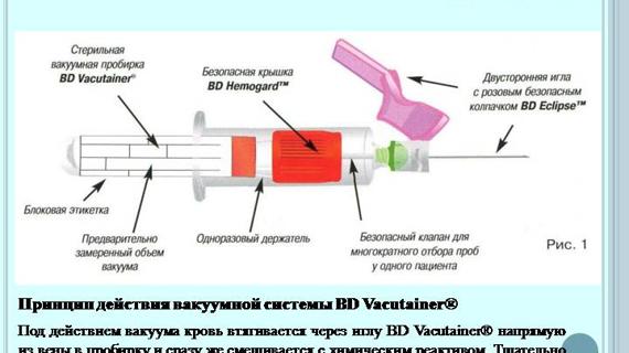 Превью картинка статьи Не получился анализ крови из вены сгусток