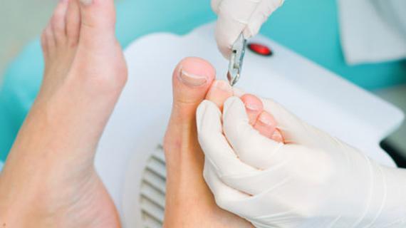 Превью картинка статьи Удаление вросшего ногтя: причины, методы, достоинства, недостатки – Медицинский портал