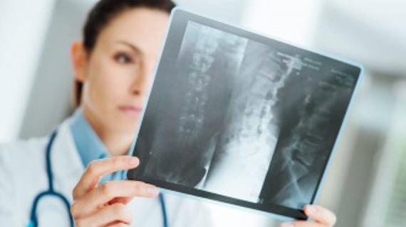 Превью картинка статьи Анализ крови на разрушение кости