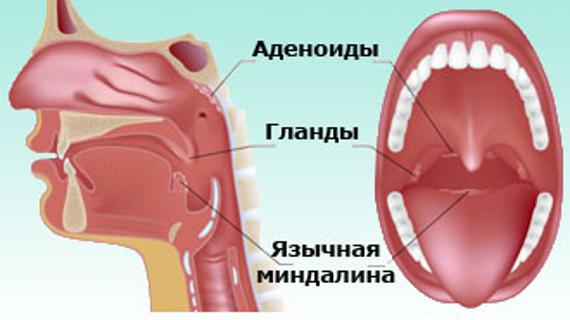 Превью картинка статьи В чем отличия лакунарной и фолликулярной ангины - в чем разница 2021