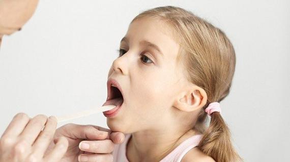 Превью картинка статьи Герпетическая ангина у детей: лечение