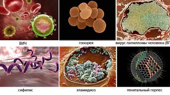 Превью картинка статьи Может ли передаться инфекция через руки